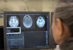 Cover photo featuring an MRI scan being evaluated